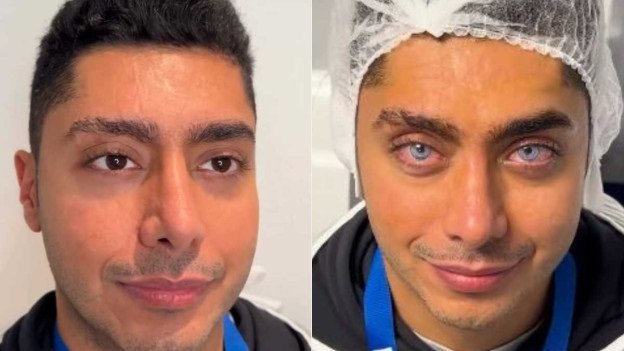 Hombre se pinta ojos de azul